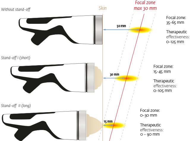 https://www.pctmedicalservices.com/img/site_assets/focus-treatment.png